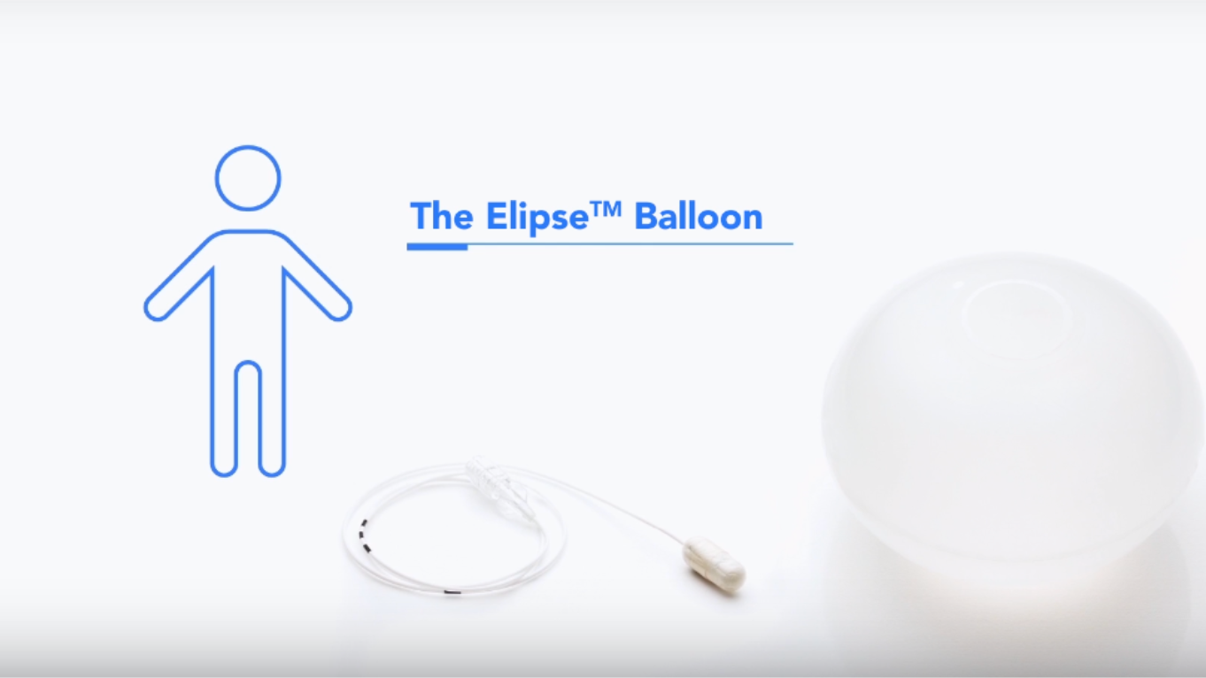 The Elipse™ Balloon Weight Loss Programme